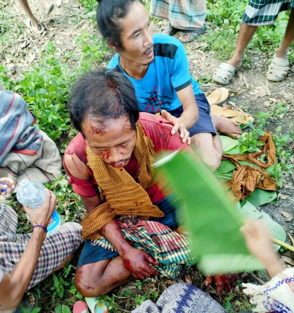 রুমায় ভাল্লুকের আক্রমণে জুমচাষী গুরুতর আহত